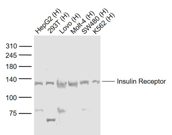 Insulin Receptor Rabbit Polyclonal Antibody