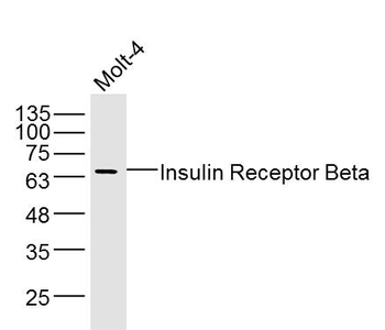 Insulin Receptor Beta Rabbit Polyclonal Antibody