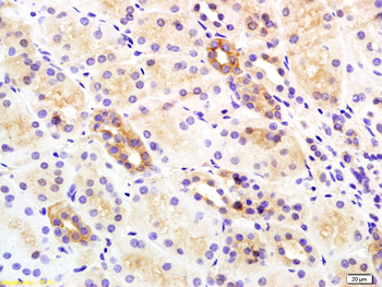 Insulin Receptor Beta Rabbit Polyclonal Antibody