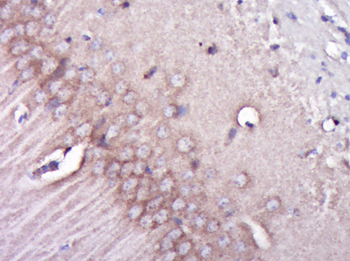 Integrin beta 1 Rabbit Polyclonal Antibody