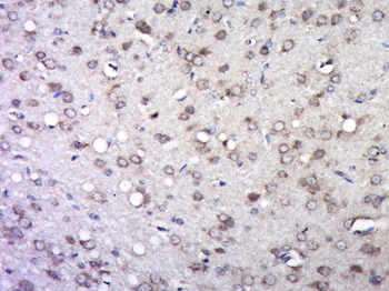 Integrin beta 1 Rabbit Polyclonal Antibody