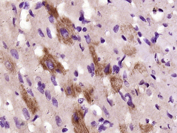 Integrin beta 1 Rabbit Polyclonal Antibody