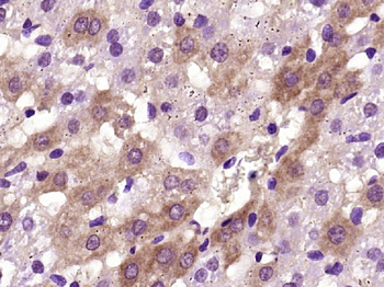 Integrin beta 1 Rabbit Polyclonal Antibody