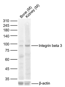 ITGB3 Rabbit Polyclonal Antibody