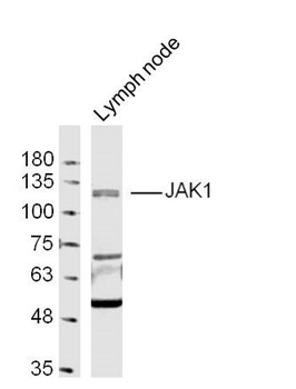JAK1 Rabbit Polyclonal Antibody