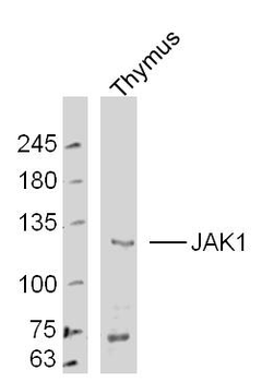 JAK1 Rabbit Polyclonal Antibody