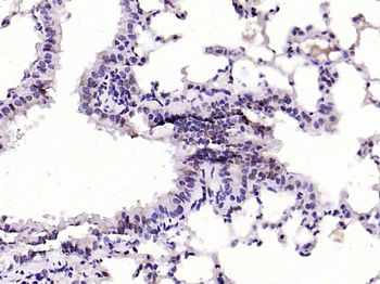 JAK2 Rabbit Polyclonal Antibody