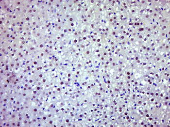 JAK2 Rabbit Polyclonal Antibody