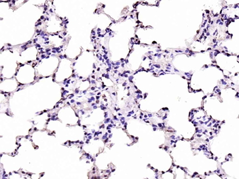 JAK2 Rabbit Polyclonal Antibody