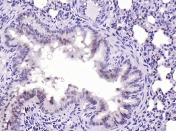 JAK2 Rabbit Polyclonal Antibody