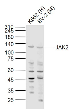 JAK2 Rabbit Polyclonal Antibody
