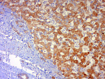 JNK1 + JNK3 Rabbit Polyclonal Antibody