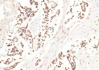 JNK1 + JNK3 Rabbit Polyclonal Antibody