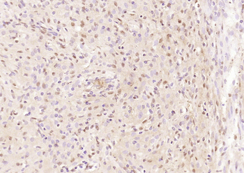 JNK1 + JNK3 Rabbit Polyclonal Antibody