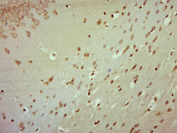 Phospho-JNK1 + 2 + 3 (Thr183+Tyr185) Rabbit Polyclonal Antibody