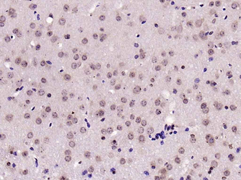 Phospho-JNK1 + 2 + 3 (Thr183+Tyr185) Rabbit Polyclonal Antibody