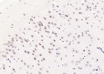 Phospho-JNK1 + 2 + 3 (Thr183+Tyr185) Rabbit Polyclonal Antibody
