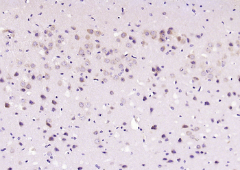 Phospho-JNK1 + 2 + 3 (Thr183+Tyr185) Rabbit Polyclonal Antibody