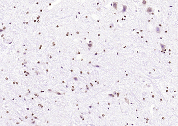 Phospho-JNK1 + 2 + 3 (Thr183+Tyr185) Rabbit Polyclonal Antibody