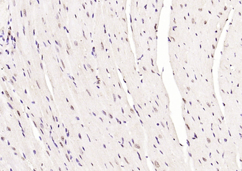 Phospho-JNK1 + 2 + 3 (Thr183+Tyr185) Rabbit Polyclonal Antibody