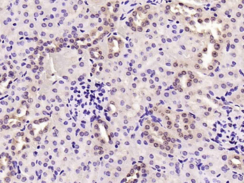 Phospho-JNK1 + 2 + 3 (Thr183+Tyr185) Rabbit Polyclonal Antibody