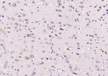 Phospho-JNK1 + 2 + 3 (Thr183+Tyr185) Rabbit Polyclonal Antibody
