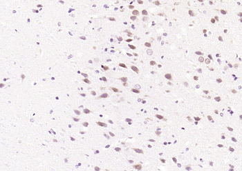 Phospho-JNK1 + 2 + 3 (Thr183+Tyr185) Rabbit Polyclonal Antibody