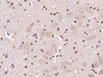 Phospho-JNK1 + 2 + 3 (Thr183+Tyr185) Rabbit Polyclonal Antibody