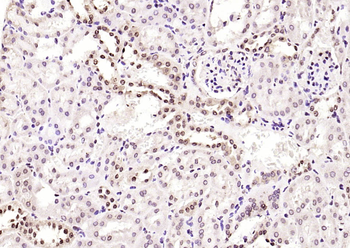 Phospho-JNK1 + 2 + 3 (Thr183+Tyr185) Rabbit Polyclonal Antibody