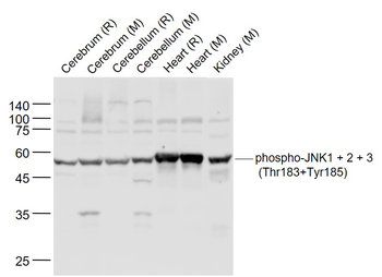 Phospho-JNK1 + 2 + 3 (Thr183+Tyr185) Rabbit Polyclonal Antibody
