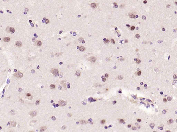 Phospho-JNK1 + 2 + 3 (Thr183+Tyr185) Rabbit Polyclonal Antibody