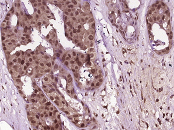 Phospho-JNK1 + 2 + 3 (Thr183+Tyr185) Rabbit Polyclonal Antibody