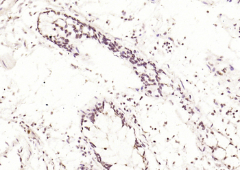 Phospho-JNK1 + 2 + 3 (Thr183+Tyr185) Rabbit Polyclonal Antibody