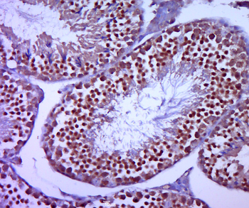 Phospho-KLF5 (Ser275) Rabbit Polyclonal Antibody