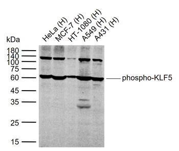 Phospho-KLF5 (Ser275) Rabbit Polyclonal Antibody