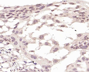 KLF6 Rabbit Polyclonal Antibody