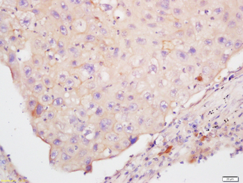 KRAS Rabbit Polyclonal Antibody