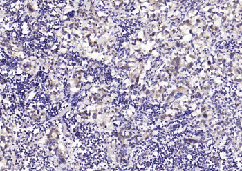 KRAS Rabbit Polyclonal Antibody