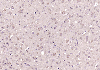 KRAS Rabbit Polyclonal Antibody