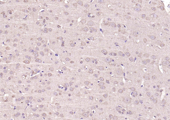 KRAS Rabbit Polyclonal Antibody