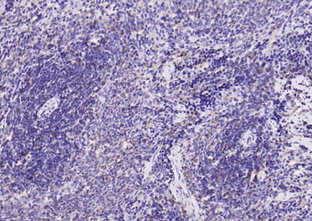 KRAS Rabbit Polyclonal Antibody