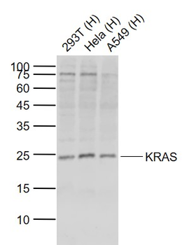 KRAS Rabbit Polyclonal Antibody