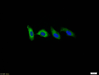 LDLR Rabbit Polyclonal Antibody