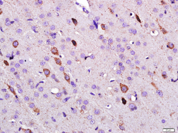 Leptin Rabbit Polyclonal Antibody