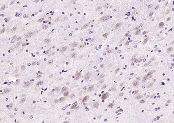Leptin Rabbit Polyclonal Antibody