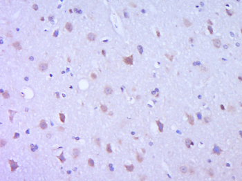 Leptin Rabbit Polyclonal Antibody