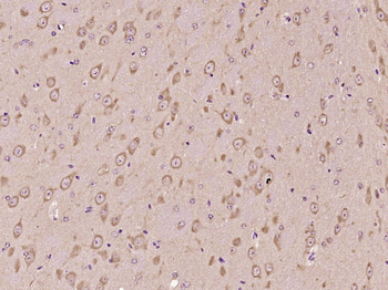PLA2G7 Rabbit Polyclonal Antibody