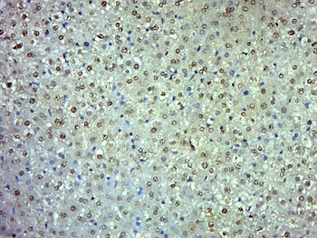 PLA2G7 Rabbit Polyclonal Antibody