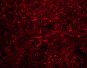 PLA2G7 Rabbit Polyclonal Antibody