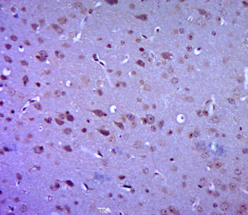 GPR49 Rabbit Polyclonal Antibody